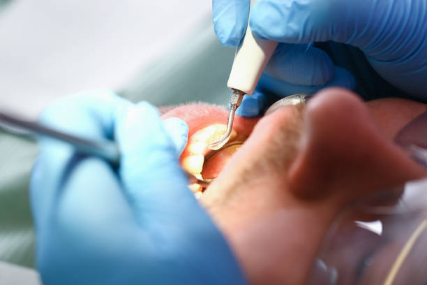 Best Dental Abscess Treatment in Crainvle, IL